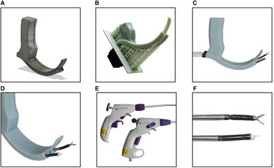 A novel 3D-printed laryngoscope with integrated working channels for laryngeal surgery